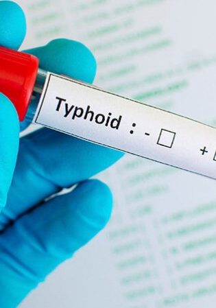 Guide Alimentation : Typhoïde